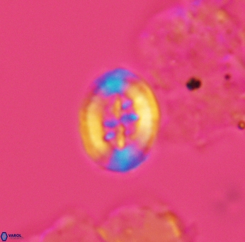 Heterorhabdus angustiforatus 3567