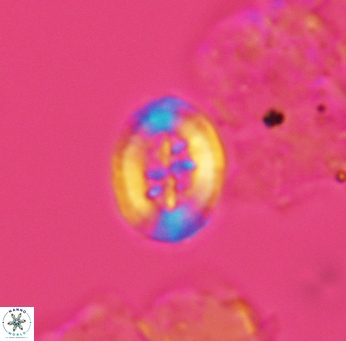 Heterorhabdus angustiforatus 3567