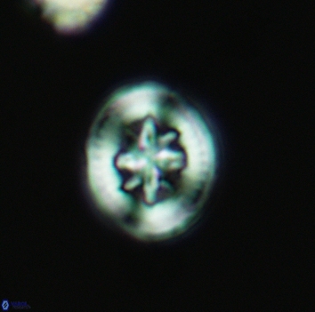 Heterorhabdus angustiforatus 3682