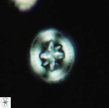 Heterorhabdus angustiforatus 3682