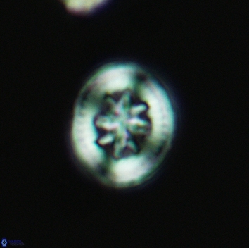 Heterorhabdus angustiforatus 3684