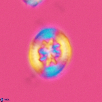 Heterorhabdus angustiforatus 3685