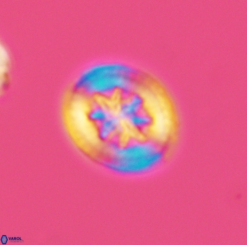 Heterorhabdus angustiforatus 3687