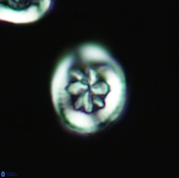 Heterorhabdus angustiforatus 3696