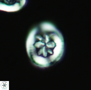 Heterorhabdus angustiforatus 3696