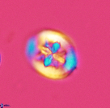 Heterorhabdus angustiforatus 3699