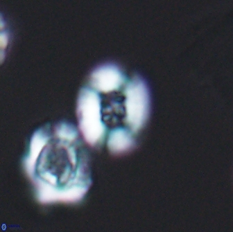 Heterorhabdus ficula 8707