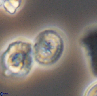 Heterorhabdus ficula 8711