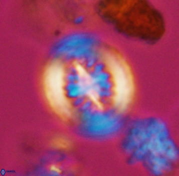 Heterorhabdus surirellus 10266