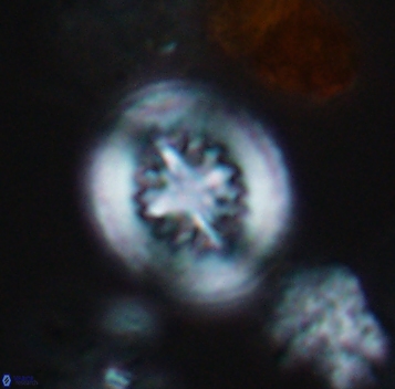 Heterorhabdus surirellus 10267