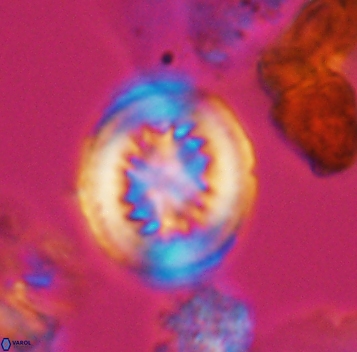 Heterorhabdus surirellus 10269