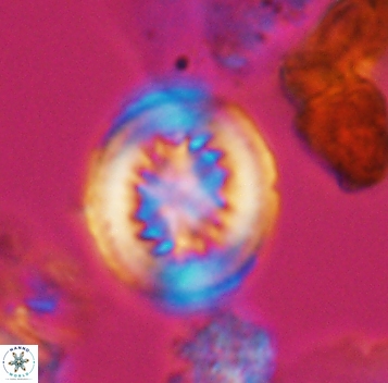 Retecapsa surirella 10269