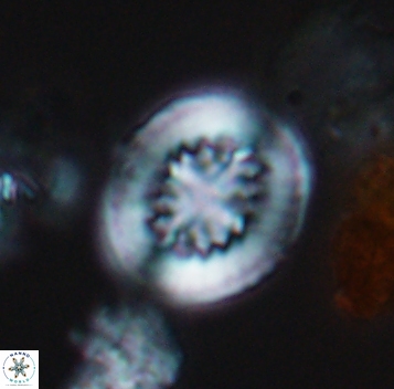 Retecapsa surirella 10270