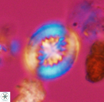 Heterorhabdus surirellus 10271