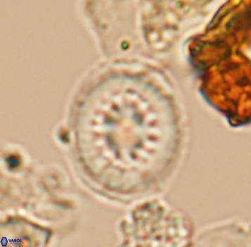 Heterorhabdus surirellus 10272