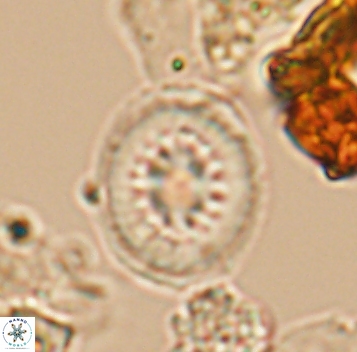 Retecapsa surirella 10272
