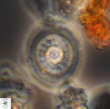 Retecapsa surirella 10273