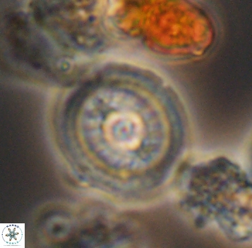 Retecapsa surirella 10274