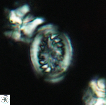 Heterorhabdus surirellus 3345