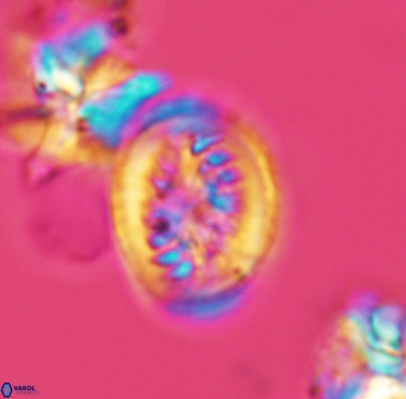 Heterorhabdus surirellus 3346