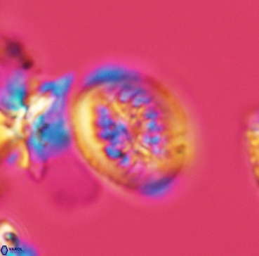 Heterorhabdus surirellus 3347