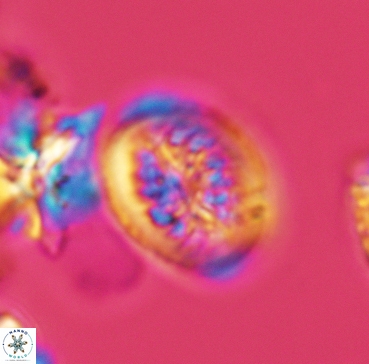 Heterorhabdus surirellus 3347