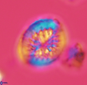 Heterorhabdus surirellus 3330