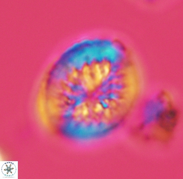 Heterorhabdus surirellus 3330