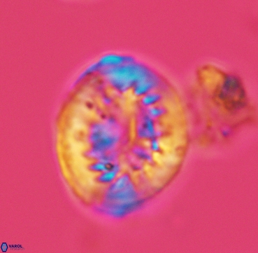 Heterorhabdus surirellus 3332