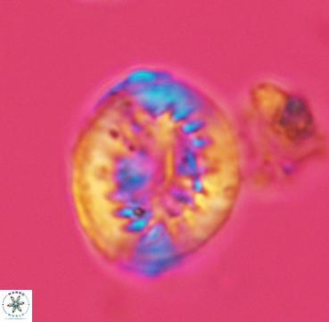 Heterorhabdus surirellus 3332