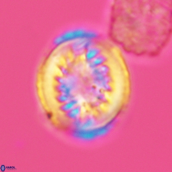 Heterorhabdus surirellus 3462