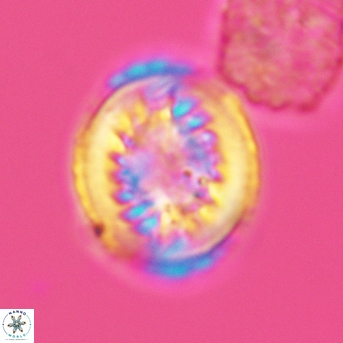 Heterorhabdus surirellus 3462