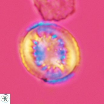 Heterorhabdus surirellus 3466