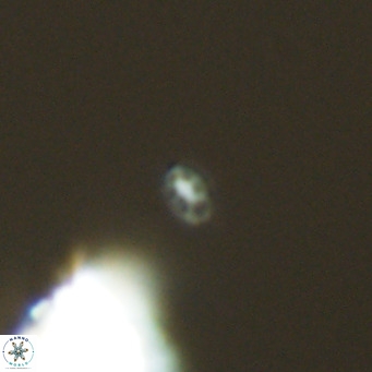 Homozygosphaera dalmatica VR 04155