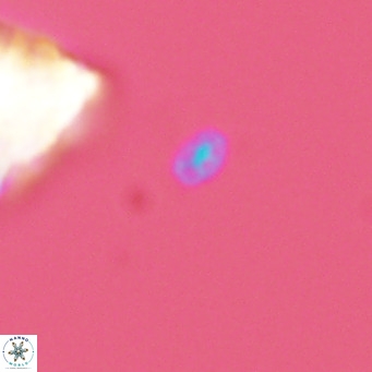 Homozygosphaera dalmatica VR 04157