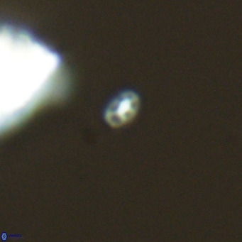 Homozygosphaera dalmatica VR 04159
