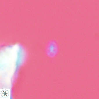 Homozygosphaera dalmatica VR 04151