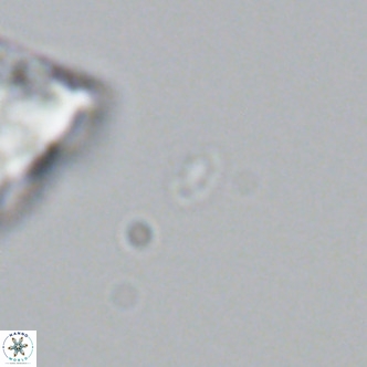 Homozygosphaera dalmatica VR 04160