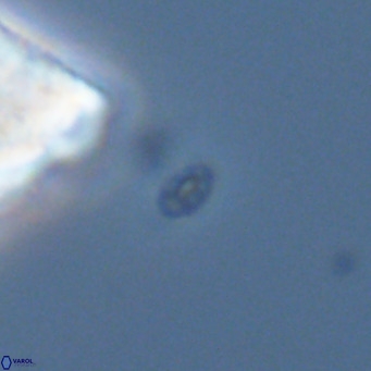 Homozygosphaera dalmatica VR 04163
