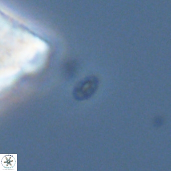 Homozygosphaera dalmatica VR 04163