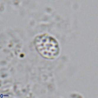 Homozygosphaera schilleri VR 08586