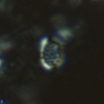 Homozygosphaera schilleri VR 08582