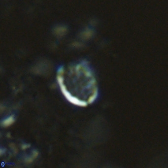 Homozygosphaera schilleri VR 08583