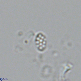 Homozygosphaera schilleri VR 08681