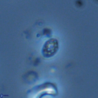 Homozygosphaera schilleri VR 08694