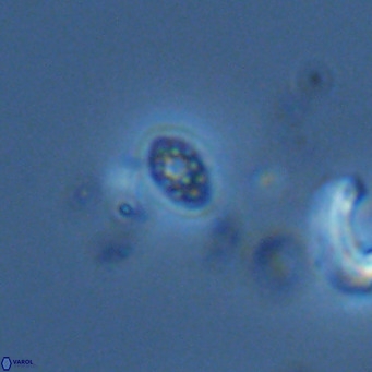 Homozygosphaera schilleri VR 08691
