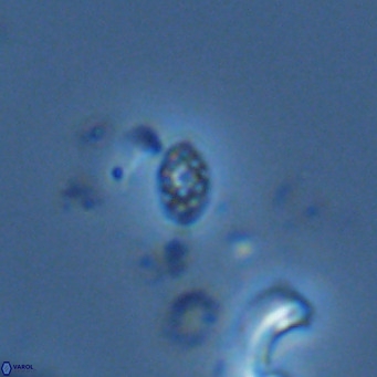 Homozygosphaera schilleri VR 08692