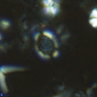 Homozygosphaera schilleri VR 08774