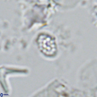 Homozygosphaera schilleri VR 08775