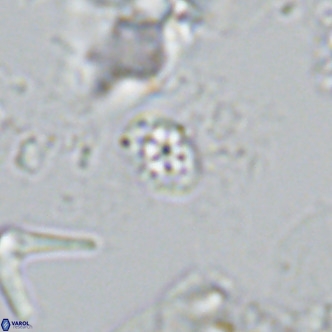 Homozygosphaera schilleri VR 08776